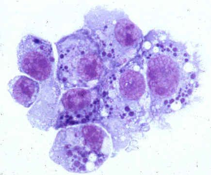 Pathogènes de l'anaplasmose humaine (famille Anaplasmataceae)