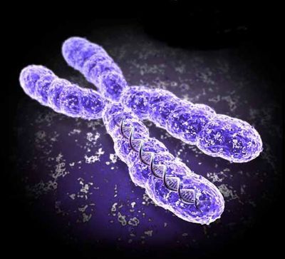 La cause de la migraine est la mutation du chromosome X