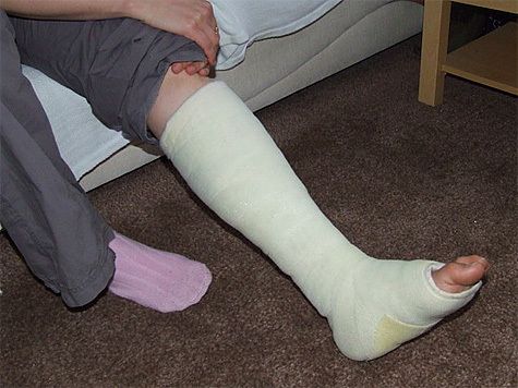 Mesures à la maison avec une fracture des jambes