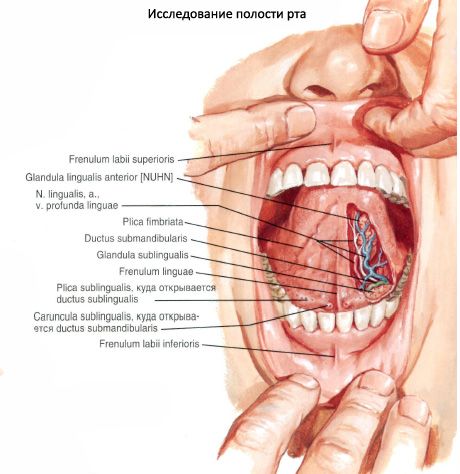 glande salivaire sublinguale