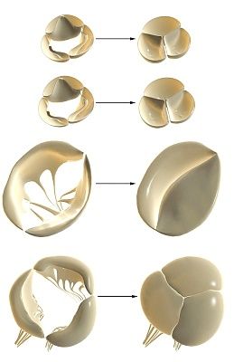 Comment fonctionnent les valves cardiaques: états de repos et de contraction
