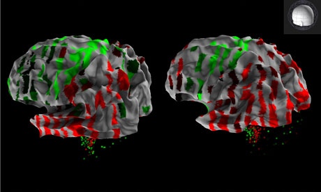 Le premier atlas mondial du cerveau humain a été créé